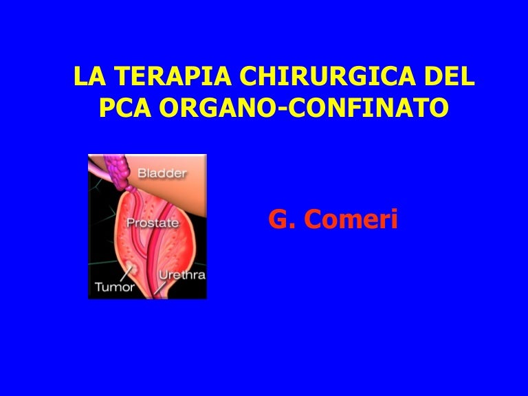 indicazioni di chirurgia del cancro alla prostata